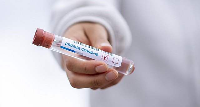 13 nuevos casos de COVID-19 en Totana en las últimas 24 horas y 393 en la Región de Murcia